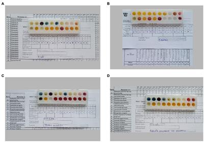 Differences in bacteria nanomotion profiles and neutrophil nanomotion during phagocytosis